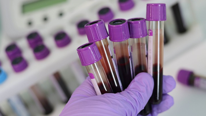 Hand h&aring;ller provr&ouml;r med blod