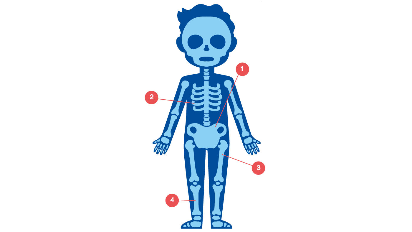 Illustration ewings sarkom